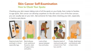 Read more about the article May is Skin Cancer Awareness Month